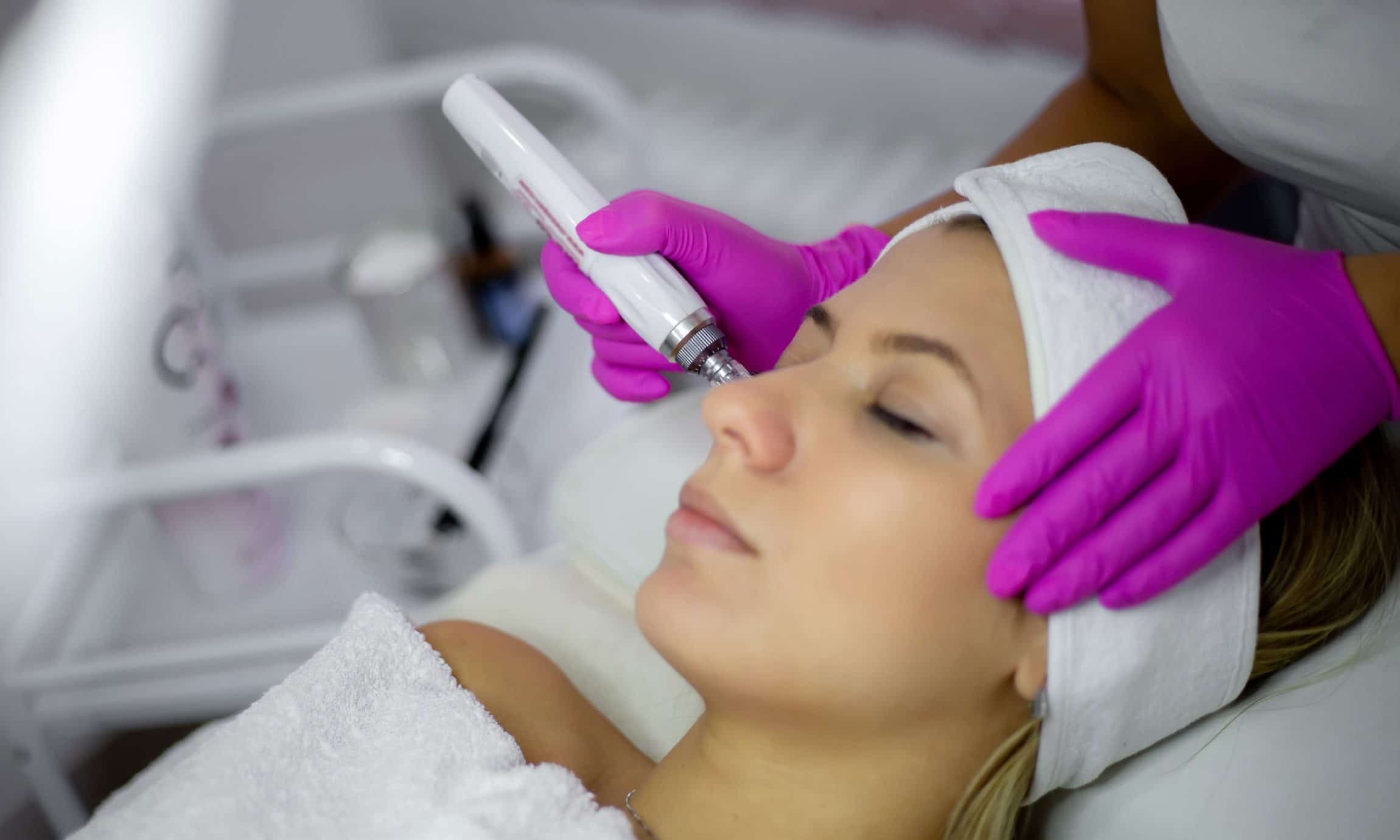 microneedling in banbury at brows by jo