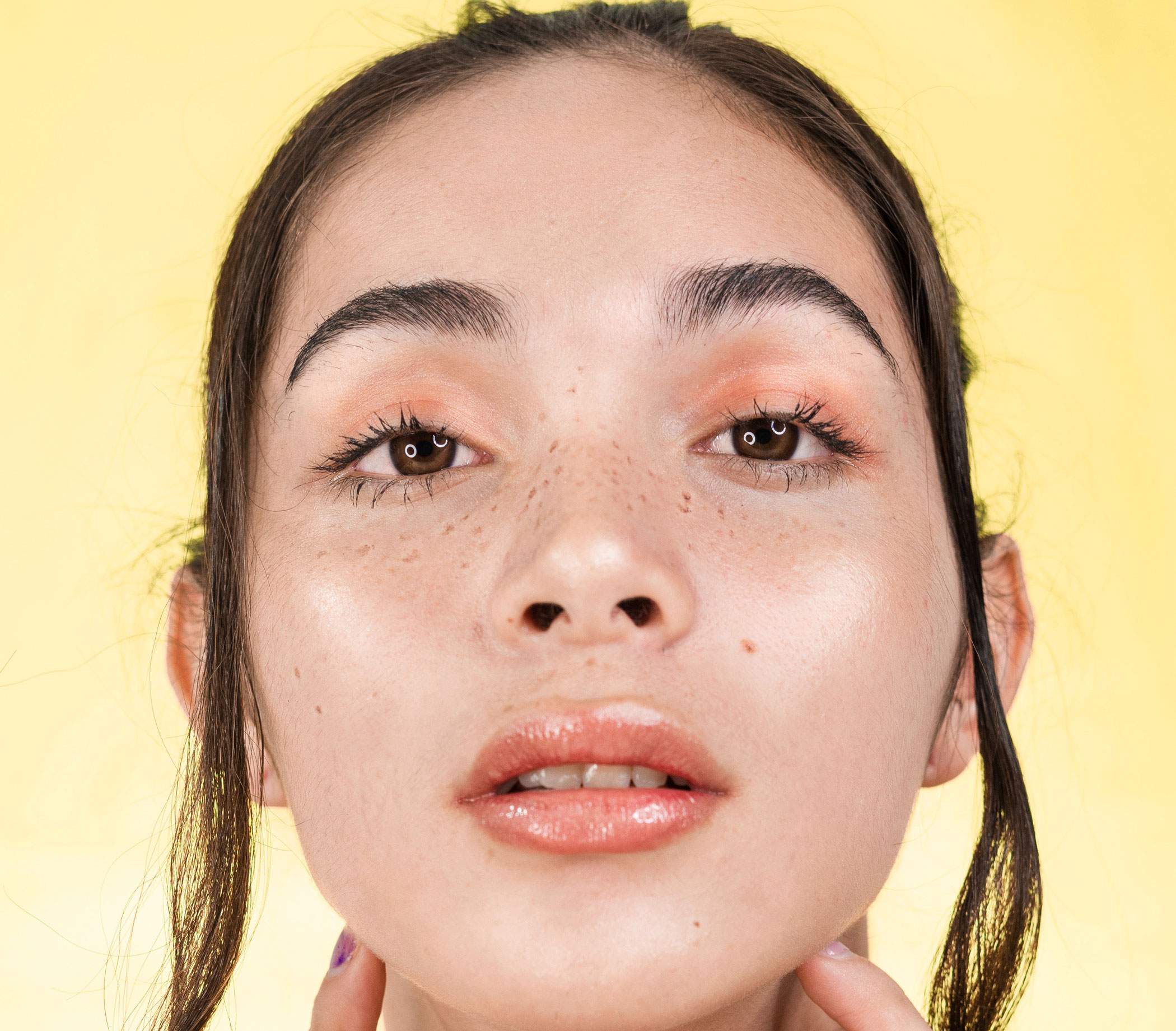 dermal fillers banbury